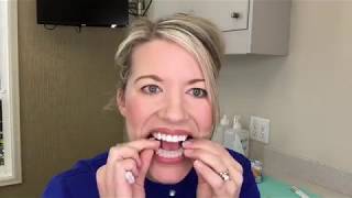 Teeth Whitening Instructions [upl. by Etteval]