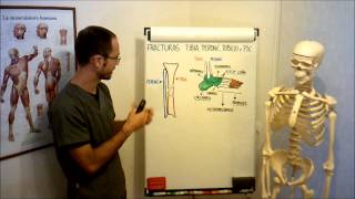 umh1729 201213 Lec018 Fracturas tibia peroné tobillo y pie [upl. by Dietrich]