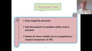 Tests for Eustachian Tube patency Valsalva manoeuvre Toynbees test [upl. by Ecylahs]