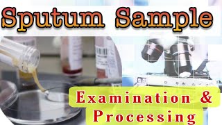 Sputum Sample Examination amp Processing [upl. by Edivad79]