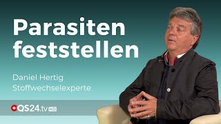 Wie merke ich ob ich Parasiten habe  Alternativmedizin  QS24 Gesundheitsfernsehen [upl. by Fisa]