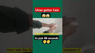 ulnar gutter cast shortsviralvideo viralvideo shortsfeeds [upl. by Sorac131]