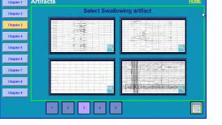 EEG Artifacts [upl. by Aneekal]