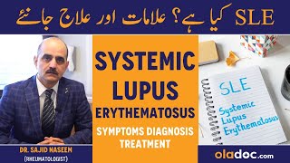 Systemic Lupus Erythematosus Causes Symptoms Treatment  Autoimmune Disease SLE Kya Hai Alamat Ilaj [upl. by Knah]