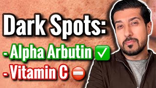 Alpha Arbutin vs Vitamin C Serum for Hyperpigmentation  Which is Better [upl. by Byrle]