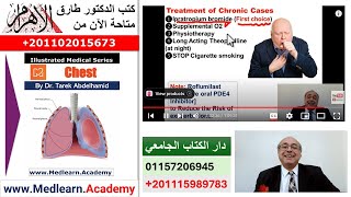 Chronic Obstructive Pulmonary Disease COPD cme internalmedicine medical usmle محاضراتباطنة [upl. by Keg]