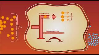 Diabetes complication Sorbitol animation [upl. by Eddana]