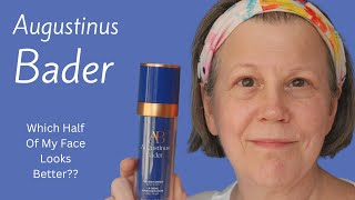 Using Augustinus Bader On Half My Face For 12 Months  Did It Help [upl. by Janith281]