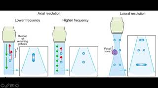 Lung Ultrasound Basics and Physics [upl. by Hutchings]