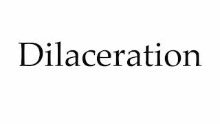 How to Pronounce Dilaceration [upl. by Roderic]