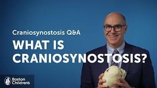 What is craniosynostosis  Boston Childrens Hospital [upl. by Brody]