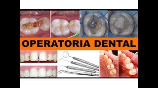 quotOPERATORIA DENTALquot por la Dra Lourdes Mejía 2 [upl. by Naryb]