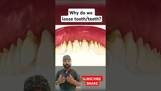 Why do we loose teeth Periodontitis explained yt short shortsfeed 3d animation dentistasmr [upl. by Jerusalem]