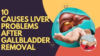 10 Causes Liver Problems After Gallbladder Removal Surgery [upl. by Guthrey]