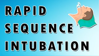 Rapid sequence intubation  Mnemonics [upl. by Kerman]