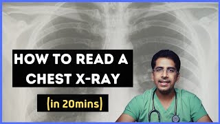 How to read a chest Xray in 20 mins [upl. by Nniuq]