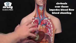 Esophageal Varices Animation Nursing Overview [upl. by Ailla]