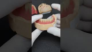 Complete full denture with lower implant  mahi dental clinic  Dr Mandeep [upl. by Lehcir871]