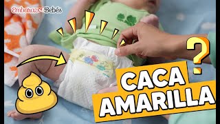 💩🟡 ¿Qué causa la CACA AMARILLA en Bebés ¿Son normales [upl. by Rayshell10]