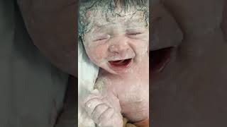 Baby have lots of vernix viralvideo newbornbaby littleprince littleheart [upl. by Conal]