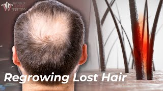 The Science of Hair Loss How to Prevent amp Regrow Lost Hair [upl. by Noval]