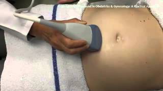 Ultrasound in Obstetrics amp Gynecology A Practical Approach  Clip 102 [upl. by Maidy338]