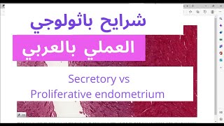 Secretory phase vs Proliferative phase endometrium  histology slide review [upl. by Marie411]