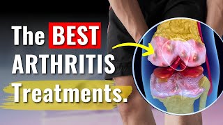 Knee Arthritis Treatments Proven to Work  The Truth You Need to Know [upl. by Getter486]