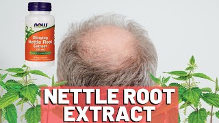 Nettle Root Extract How Does It Work For Hair Loss [upl. by Beatriz938]