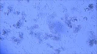 LACTOBACILLUS ACIDOPHILUS  LACTOBACILLUS RHAMNOSUS [upl. by Ornstead545]