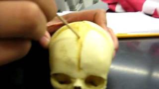 Fetal Skull Skeletal System [upl. by Dukey538]