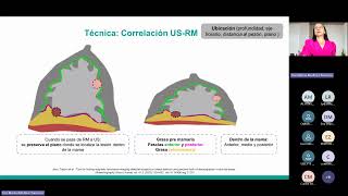 Ecografía mamaria [upl. by Dudley]