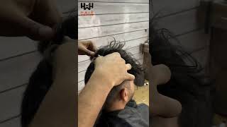 Hair Clip Method  Hair patch For men [upl. by Scarlett]