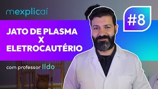 mexplicaí 08 Diferença entre Jato de Plasma e Eletrocautério  RentalMed [upl. by Kain295]