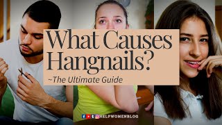 What Causes Hangnails The Ultimate Guide [upl. by Yoccm]