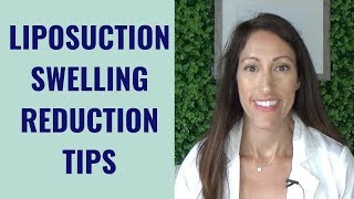 Liposuction Healing amp Recovery Tips  How to REDUCE Lipo Swelling  Post Liposuction Care Guide [upl. by Lucretia]