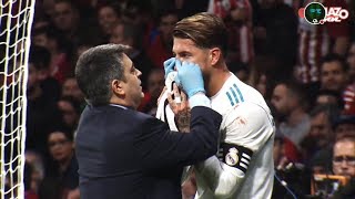 LOS DETALLES DE LA LESIÓN DE SERGIO RAMOS [upl. by Nnylirak]