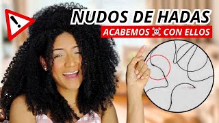 NUDOS DE HADAS ¿Por qué salen ¿Cómo cuidarlos ¿Cómo evitarlos Te cuento todo 🔥 [upl. by Htebzile]