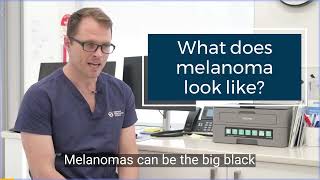 What does melanoma look like [upl. by Eeima]