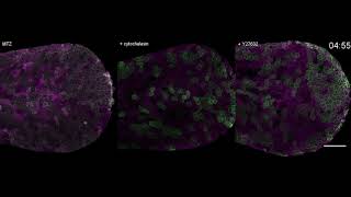 How unfit cells are extruded from epithelial tissues [upl. by Ahseekat703]