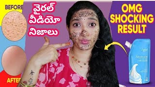 Salicylic Acid Mask in TeluguSalicylic Acid Ice Cream Mask Review in TeluguSalicylic acid icecream [upl. by Grindle375]