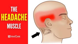 The Headache Muscle How to Release It for INSTANT RELIEF [upl. by Atterahs]