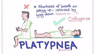 PlatypneaOrthodeoxia Syndrome [upl. by Cummings]