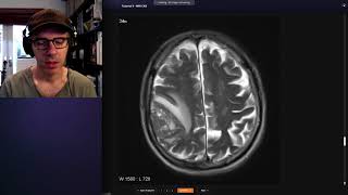 How to use Radiopaedia to teach [upl. by Asennav297]