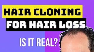 Hair Cloning for Hair Loss [upl. by Llednav498]