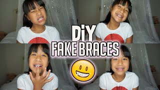 DIY FAKE BRACES SUPER EASY TRENDY ON TIKTOK [upl. by Lashonda]