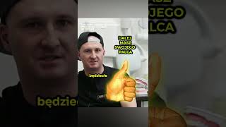 😱TNIEMY KCIUKA Implant Zęba Czy Leczenie Kanałowe 🤔 [upl. by Zalea]