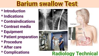 Barium swallow test with Easy Explanation bariumswallow Procedure in radiology By BL kumawat [upl. by Yaffit]