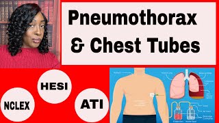 Caring for the patient with a Pneumothorax [upl. by Ula746]