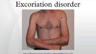 Excoriation disorder [upl. by Towers648]